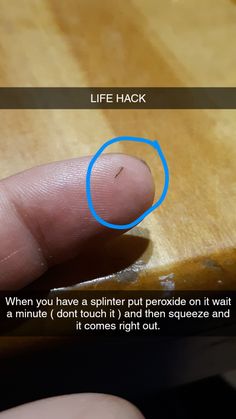 Thorn Finger Tattoo, Shoe Bite Hacks, Thorn Bone Comics, Rose Thorn Bud Check In, Thorn Accessories, Sick Remedies, Everyday Hacks