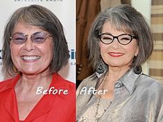 before and after photos of an older woman with gray hair, wearing black rimmed glasses