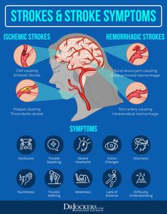 Cerebrovascular Disease: Causes, Symptoms & Support Strategies Dizziness Causes, Neurological Disorders, Medical Knowledge, Sciatica, Health Info, Brain Health, Health Facts, Health Remedies