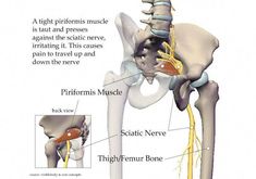 an image of a diagram of the hip and pel girdum bones with caption