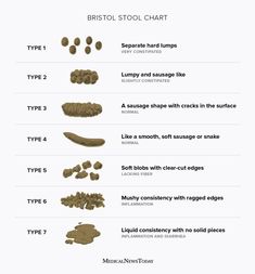 Bristol Stool scale: Stool types and what they mean Renal Physiology, Bristol Stool, Stool Chart, Bristol Stool Chart, Rectal Prolapse, Healthy Bowel Movement, In Bathroom, Home Remedies, Natural Remedies