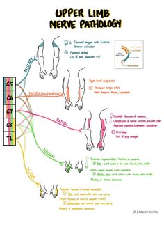 the upper limb nerve patholoy is shown in this diagram, and it shows