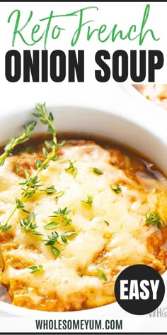 Low Carb Keto French Onion Soup Recipe Keto French Onion Soup, Bread Crust, Onion Soup Recipe, Low Carb Soup Recipes, French Onion Soup Recipe, Onion Soup Recipes, Healthy Low Carb, Keto Soup, Low Carb Soup