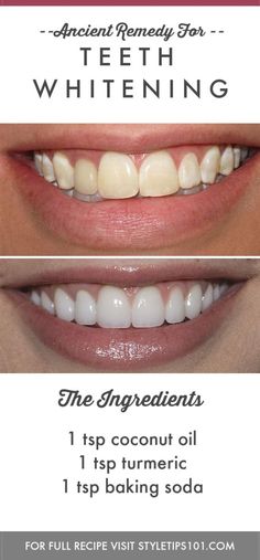 Teknik Makeup, Teeth Whitening Homemade, Teeth Whitening Remedies, Teeth Whitening Diy, Tooth Enamel, The Teeth, Natural Teeth Whitening, Natural Teeth, White Teeth