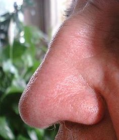 I'm intrigued by the shape of this nose and how far it sticks out from the face. Human Nose, Sinus Allergies, Allergic Rhinitis, Makeup Photo, Stem Cell Therapy, Makeup Class, Sinus Infection