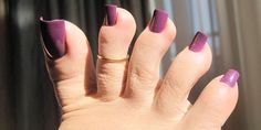 Nails For Toes, Broken Toenail, Purple Toes, Fake Toenails, Long Fingernails, Ingrown Nail, Acrylic Toe Nails