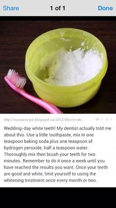 Diy Teething, Yellow Teeth, Natural Teeth Whitening, Whitening Toothpaste, Natural Teeth, Oral Health Care, Hydrogen Peroxide