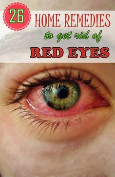 Do you keep rubbing your eyes frequently; or keep rushing even when you are fatigued? Your eyes can tell tales of your tiredness. Being awake for long work hours aggravates the condition of red eyes. Subconjunctival hemorrhage (broken blood vessels on scl Eye Stye Remedies, Allergic Rhinitis, Natural Home Remedies, Eye Health, Natural Medicine