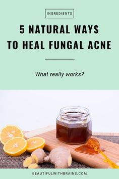 Get Rid Of Fungal Acne, Remove Pimples Overnight, To Remove Pimples, Remove Pimples, Ways To Heal, Pimples Overnight