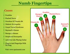 Numb Fingertips or fingertip numbness can be caused due to frost bite, carpal tunnel syndrome, pinched nerve, or activities like walking, playing guitar, exercising etc. Numb Fingertips, Numbness In Hands, Pinched Nerve, Elbow Pain, Feeling Numb, How To Cut Nails