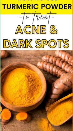 Acne Face Mask Homemade, Turmeric For Skin, Remedies For Acne, Pimples On Face, Shaving Tips, Acne Dark Spots, Acne Face Mask