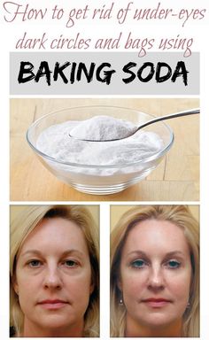 Brown Spots On Hands, Obličejové Masky, Brown Spots On Face, Spots On Face, Baking Soda Shampoo, Under Eye Bags, Beauty Remedies, Homemade Beauty Products, Health And Beauty Tips