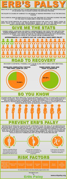 Infographic Guide To Erb–Duchenne Palsy Shoulder Dystocia, Nicu Nursing, Science Infographics, Pediatric Pt, Nurse Tattoo