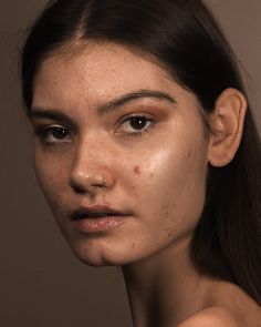 Peter Devito, Skin Positivity, Acne Beautiful, Different Skin Types, Makijaż Smokey Eye, Beauty Standards