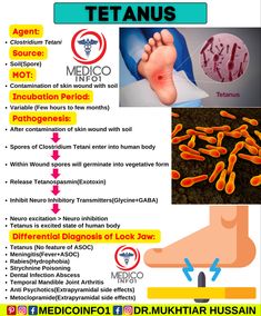 an info sheet with information about the different types of foot funguss and how to use them