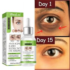 Eye Firming Serum ,Aging Eye Serums For Women & Men - Reduces Puffiness, Dark Circles, Under Eye Bags, Wrinkles And Fine Lines Around The Eyes20ML Features: [ Disappear Under-Eye Wrinkles & Bags in 3 Minutes ] - Our firming serum is a fast-acting that helps reduce lines, puffiness and wrinkles, instantly. Fortified with powerful ingredients, it quickly rejuvenates your skin leaving you looking and feeling more youthful! [ Lift, Tighten and Smooth Out Under-Eye Problems ] - Our special fast-actin Skin Care Eye Cream, Eye Firming, Eye Wrinkles, Eye Problems, Eye Cream For Dark Circles, Under Eye Wrinkles, Firming Serum, Dark Circles Under Eyes, Dark Under Eye