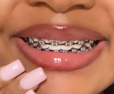 a close up of a woman's mouth with braces on her teeth and pink manicures