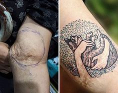 Times People Asked Tattoo Artists To Cover Up Their Scars And Birthmarks Old Tattoos