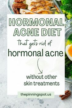 Hormonal acne diet that includes acne fighting foods to get rid of hormonal acne without any other skin treatments. So if you're looking for foods that help with acne esp. hormonal acne, then these foods to eat for clear skin will help your hormonal acne without skin treatments. hormonal acne diet | acne fighting foods | acne foods to eat | foods that help with acne | top acne fighting foods | Clean eating | clear skin diet | what foods to eat for clear skin | skin issue | skin treatments Cheek Pimples, Eat For Clear Skin, Acne Drink, Anti Acne Diet, Skin Treatments For Acne, Get Rid Of Hormonal Acne, Treatments For Acne