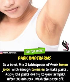 Upper Lip Darkness How To Remove, Lighten Lips, How To Whiten Underarms, Clear Healthy Skin, Natural Skin Care Remedies, Dark Underarms, Natural Face Skin Care, Good Skin Tips, Beauty Tips For Glowing Skin