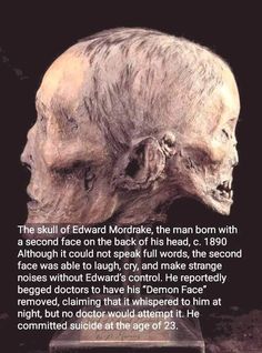 an image of a skull with a quote on it that says, the skull of edward mor