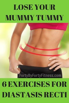 Lose your mummy tummy - 6 exercises to help correct Diastasis Recti Post Baby Workout, Mummy Tummy, Diastasis Recti Exercises, Mommy Tummy, Baby Workout, Mommy Workout, Diastasis Recti, Post Partum Workout, Trening Abs