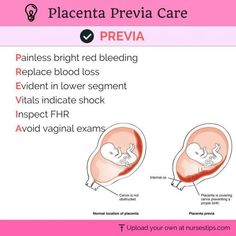 the diagram shows how to use preva care for pregnants and their infant's stomach