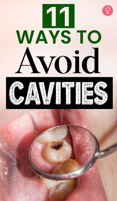 We were scared of cavities as a kid and we should worry about it as an adult too. Here are eleven ways that will definitely help you to avoid cavities..
#remediesforgumpain Reverse Cavities, Stronger Teeth, Oral Health Care, Tooth Decay