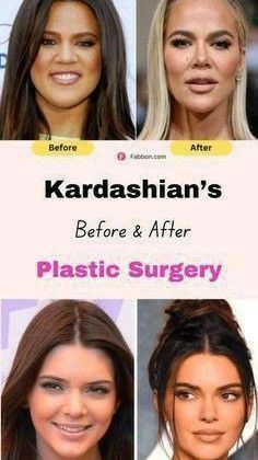 Kardashians Before And After, Hair Mistakes, Facial Plastic Surgery