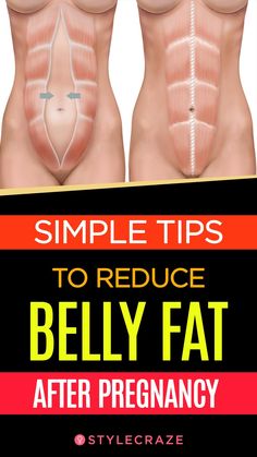 10 Simple Tips To Reduce Belly Fat After Pregnancy #women #pregnancy Pregnancy Women, Exercise Ideas, Mommy Dearest, Belly Fat Diet, Health Nut, Stomach Fat, Pregnant Belly