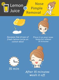 Pimples on the nose are quite tricky to deal with. Read this article to learn the causes and natural remedies to cope with them effectively. Pimples On Forehead, Get Rid Of Pimples, Rid Of Pimples, Homemade Toilet Cleaner, Clean Baking Pans, Prevent Pimples, Cleaning Painted Walls, Deep Cleaning Tips