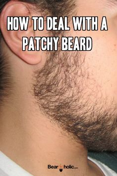 Beard Man, Thick Beard, Bald With Beard, Perfect Beard