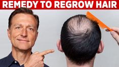 How to Regrow Hair (the Two Causes of Hair Loss) – Dr. Berg - YouTube Regrow Hairline, How To Regrow Hair, Hair For Men, Natural Hair Regrowth, Dr Eric Berg, Going Bald, Dr Berg