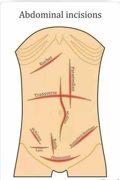 the back and side view of an adult's abdomen, with arrows pointing to different areas