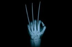 an x - ray image of a hand holding something in it's left hand