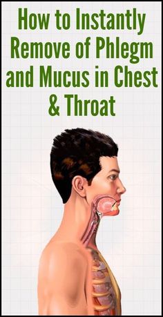 Get Rid of Phlegm and Mucus in Chest & Throat with These Home Remedies #NaturalRemediesForCoughAndCold Chest Infection Remedies, Mucus In Chest, Getting Rid Of Phlegm, Natural Decongestant, Chest Infection, Home Remedy For Cough, Natural Cough Remedies, Cold Home Remedies, Cough Remedies