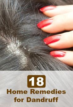 Healthy Hair Care Routine, Scalp Remedies, Dandruff Removal, Hair Mask For Dandruff, Coffee Facial, Thick Hair Remedies