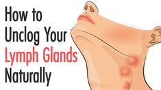 How to Unclog Your Lymph Glands Naturally Punkty Spustowe