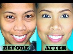 have a puffy eye? or dry under eye? well this video is for you. On this video ill share with you my home remedy on how i depuff my bags, how i conceal and hi... Bags Under Eyes Remedy Get Rid Of, Bags Under Eyes Remedy Fast, Puffy Eye Makeup, How To Get Rid Of Eye Bags Fast, Under Eye Bags Remedies, How To Conceal Under Eye Bags, Bags Under Eyes Remedy, Eye Bags Remedy, Undereye Bags Remedy