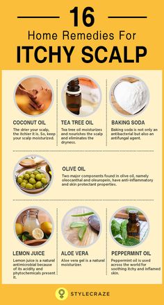 Remedies For Itchy Scalp, Dry Scalp Remedy, Natural Aloe Vera Gel, Natural Healing Remedies, Itchy Scalp, Hair Remedies, Dry Scalp, Natural Home Remedies