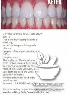 Whiter teeth in 2 minutes with baking soda and coconut oil – Koperacija All people can agree that it is a beautiful smile that is one of the main weapons of a person. A seductive smile is impossible... White Teeth Tips, Teeth Tips, Best Teeth Whitening Kit, Charcoal Teeth Whitening