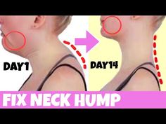 a woman's neck is shown with an arrow pointing to the right and left side