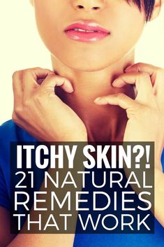 Itchy Skin Remedies, Itchy Skin Remedy, Itchy Skin Relief, Home Remedies For Skin, Itching Skin, Allergy Remedies, Dry Skin Remedies, Itch Relief