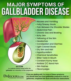 Bile Flow: Top 15 Herbs to Support Liver & Gallbladder - No Gallbladder Diet, Bitter Taste In Mouth, Tea Benefits Health, No Gallbladder, Liver Rescue, Green Tea Benefits Health, Gallbladder Cleanse, Gallbladder Stones