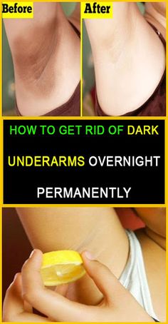 How to Get Rid of Dark Underarms Overnight Permanently – Beauty Ino Health And Fitness Articles, Diy Beauty Hacks, We Are The World