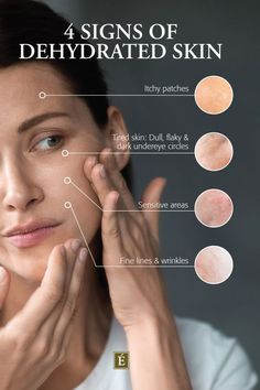 Is your skin dry or dehydrated? Here's a quick lesson on the difference between dry and dehydrated skin, as well as tips for returning your complexion to its natural glow. Signs Of Sensitive Skin, Skin Care Education, Dehydrated Skin Face, Skin Content Ideas, Skin Education, Beauty Education, Skin Dehydration, Glow Your Skin, Remove Skin Tags Naturally