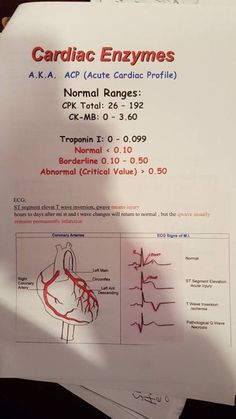 a sheet of paper with instructions on how to use the cardiac enzymes