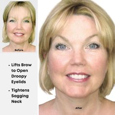 Sagging Neck, Droopy Eyelids, Droopy Eyes, Instant Face Lift, Eye Skin Care, Anti Aging Secrets, Try On Hairstyles, Neck Lift, Brow Lift