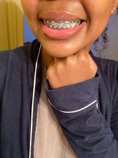 Brace Tips, Navy Blue Braces, Power Chain Braces, Blue Braces, Braces Ideas, Braces And Glasses, Shiny Teeth