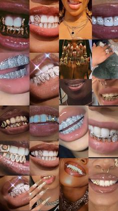 many different pictures of teeth and braces with diamonds on them, all in various colors